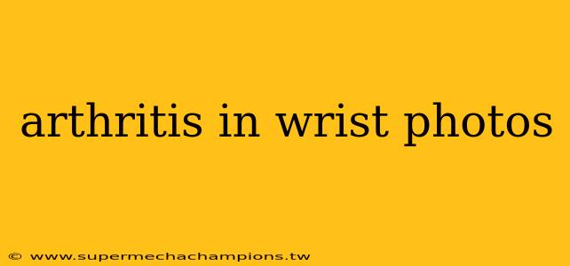 arthritis in wrist photos