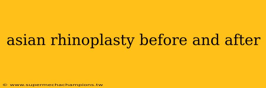 asian rhinoplasty before and after
