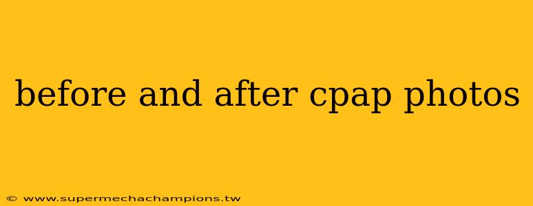 before and after cpap photos
