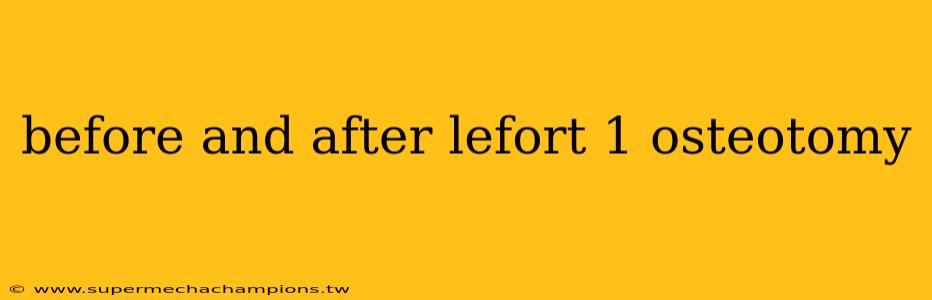 before and after lefort 1 osteotomy