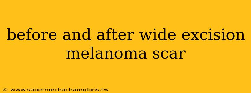 before and after wide excision melanoma scar