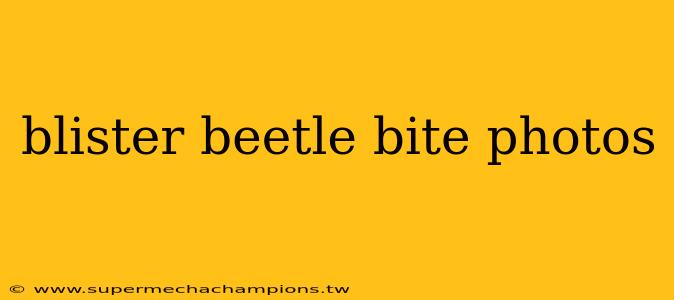 blister beetle bite photos