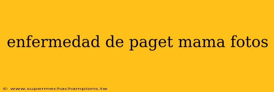 enfermedad de paget mama fotos