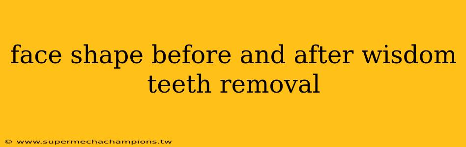 face shape before and after wisdom teeth removal