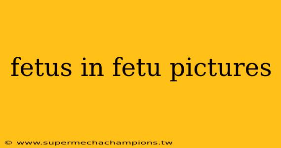 fetus in fetu pictures