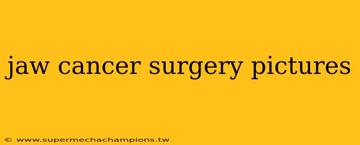 jaw cancer surgery pictures