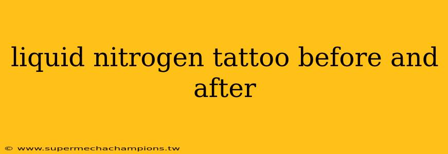 liquid nitrogen tattoo before and after
