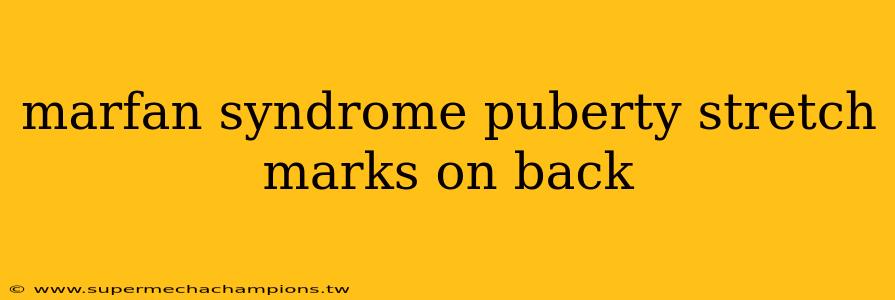 marfan syndrome puberty stretch marks on back