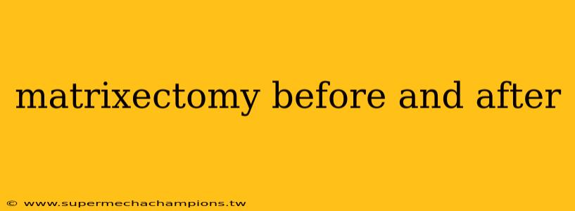 matrixectomy before and after