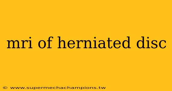 mri of herniated disc