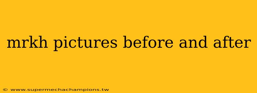 mrkh pictures before and after