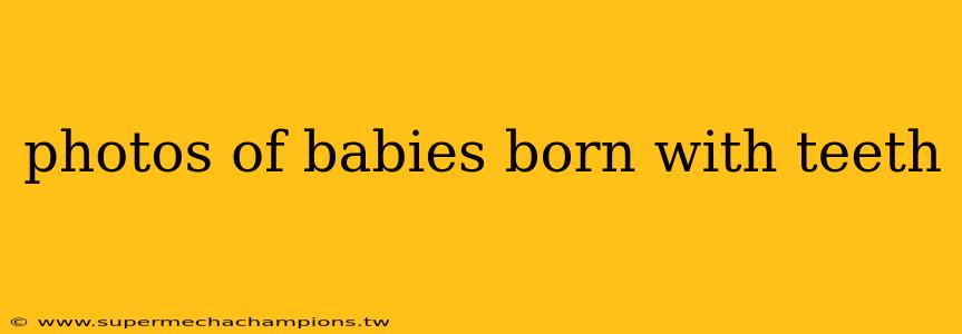 photos of babies born with teeth
