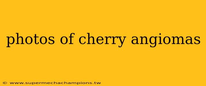 photos of cherry angiomas