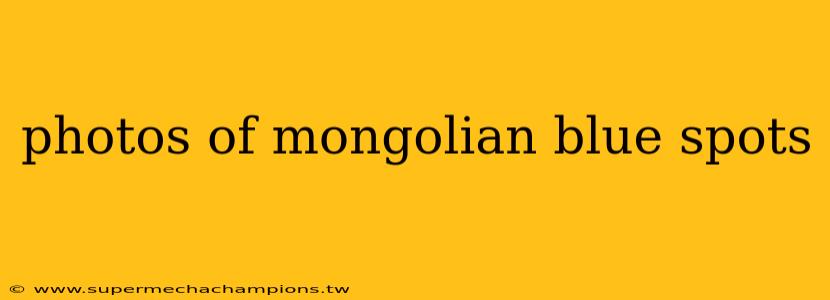 photos of mongolian blue spots