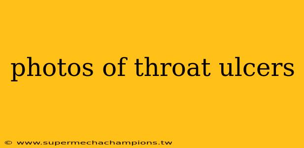 photos of throat ulcers