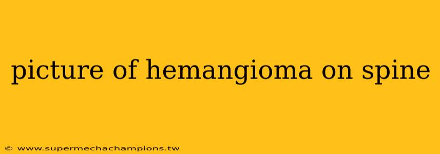 picture of hemangioma on spine