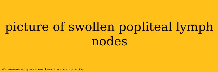 picture of swollen popliteal lymph nodes