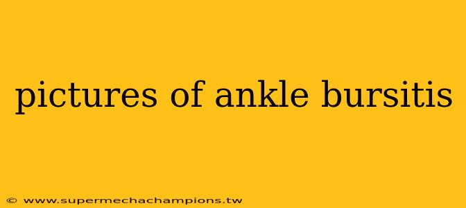pictures of ankle bursitis