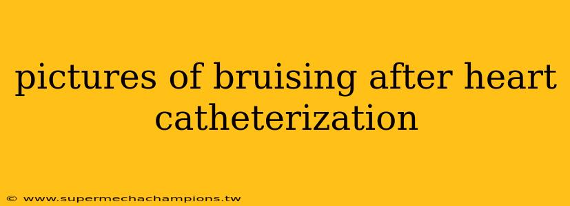 pictures of bruising after heart catheterization
