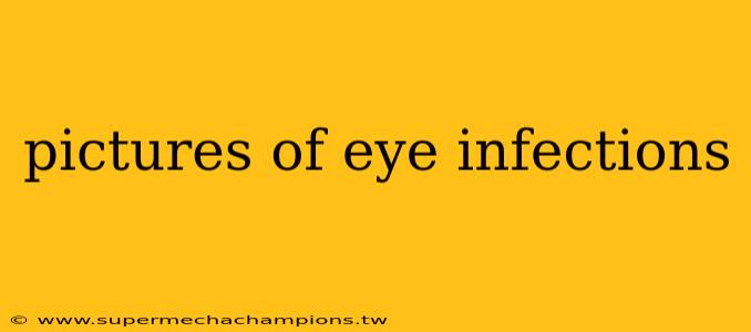 pictures of eye infections