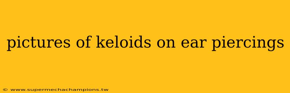 pictures of keloids on ear piercings