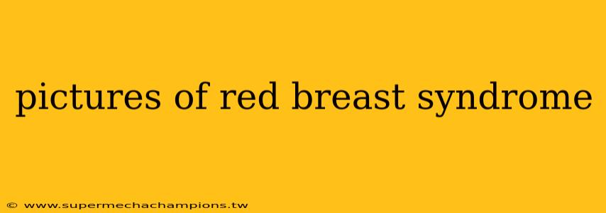 pictures of red breast syndrome