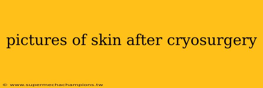 pictures of skin after cryosurgery