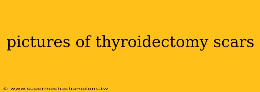 pictures of thyroidectomy scars