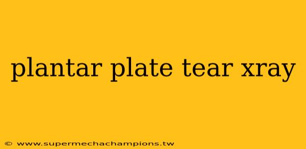 plantar plate tear xray