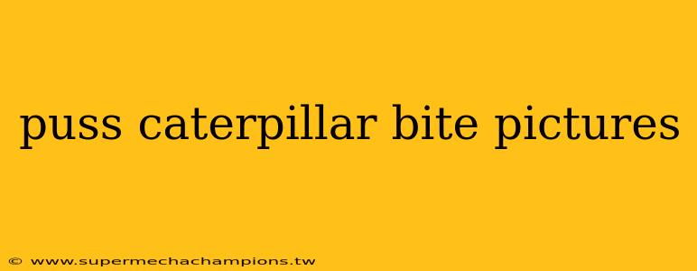 puss caterpillar bite pictures