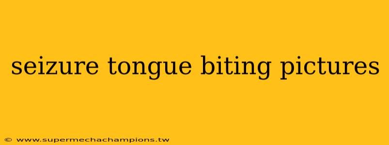 seizure tongue biting pictures