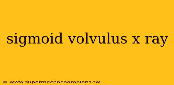 sigmoid volvulus x ray