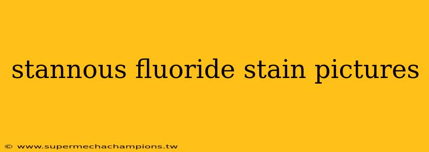 stannous fluoride stain pictures