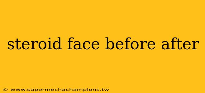 steroid face before after