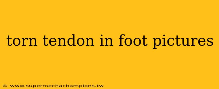 torn tendon in foot pictures
