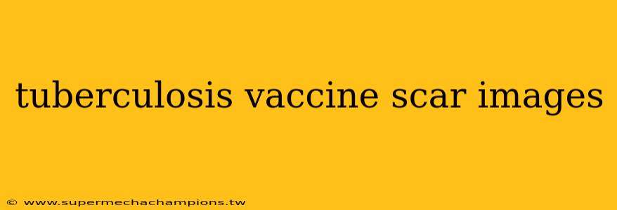 tuberculosis vaccine scar images