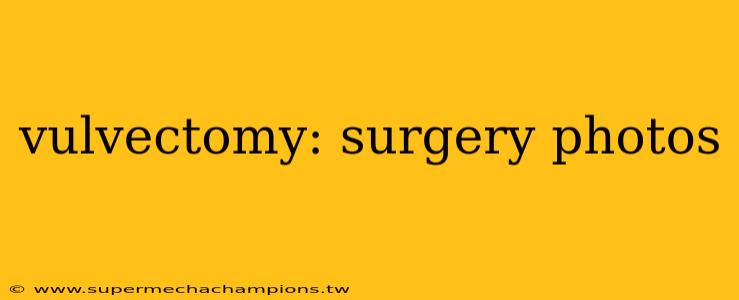 vulvectomy: surgery photos